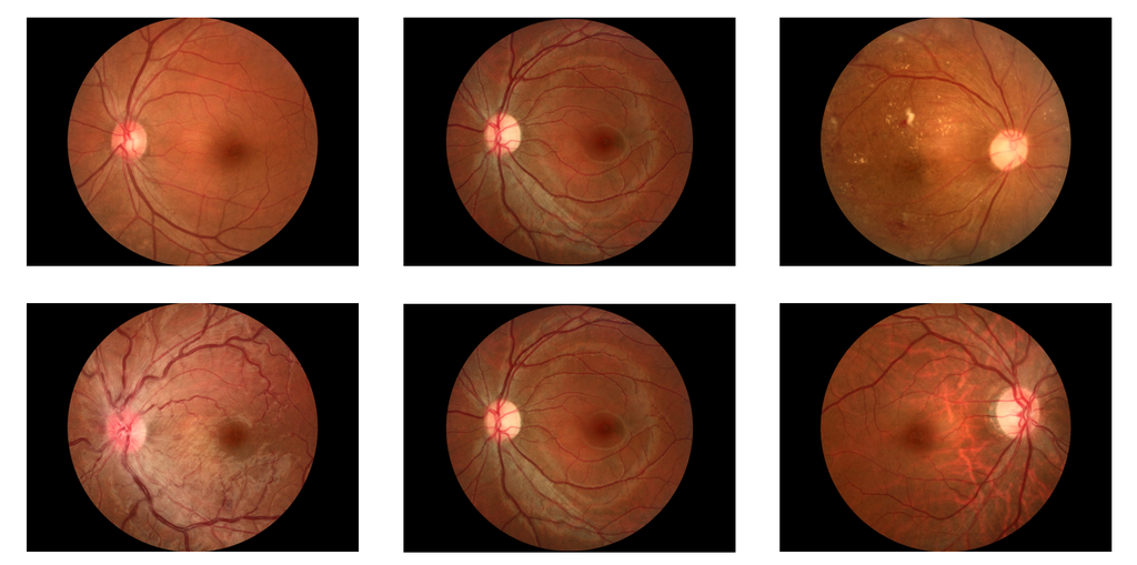 0903 Retinal Camera