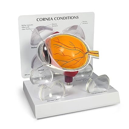 ​Cornea Eye Model