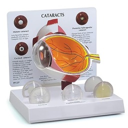 [EA-01] ​Cataract Eye Anatomical model